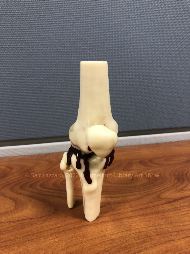 Photograph of a 3D printed knee joint with dark red sealing wax mimicking blood dripping from the joint.