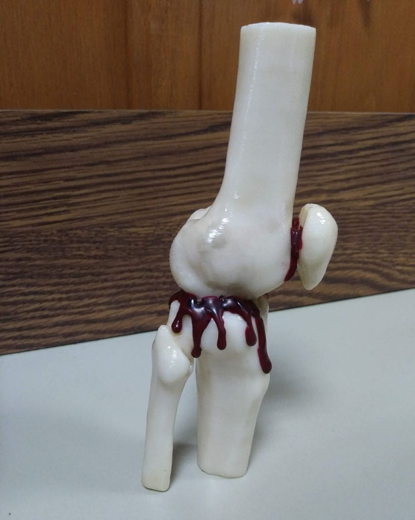 Picture of a 3D printed knee joint with red wax resembling blood dripping from the joint.